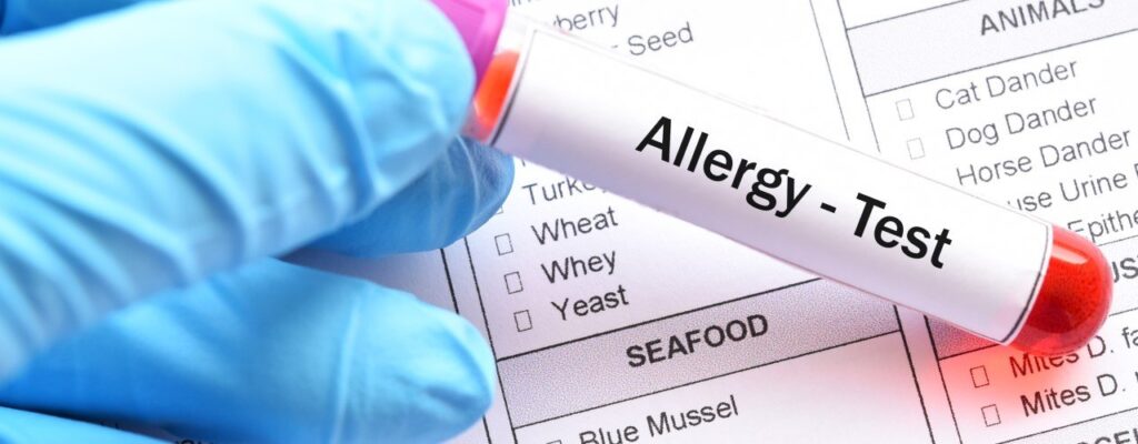 attachment-food-allergies
